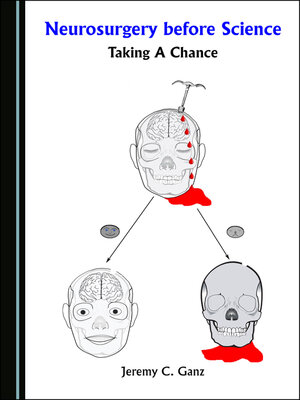 cover image of Neurosurgery before Science: Taking a Chance